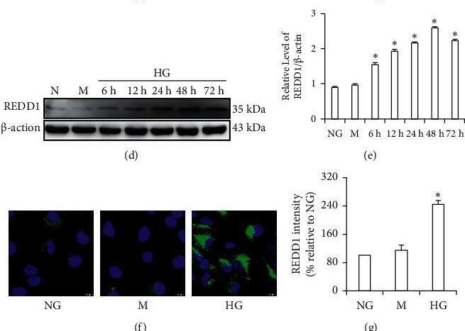 Fig.2.N showing Immunocytochemistry-immunofluorescence in a Mus musculus (House mouse) sample from the publication: Blocking REDD1/TXNIP Complex Ameliorates HG-Induced Renal Tubular Epithelial Cell Apoptosis and EMT through Repressing Oxidative Stress.