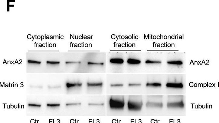 Fig.4.F showing Western Blotting from the publication: The flavagline FL3 interferes with the association of Annexin A2 with the eIF4F initiation complex and transiently stimulates the translation of annexin A2 mRNA.