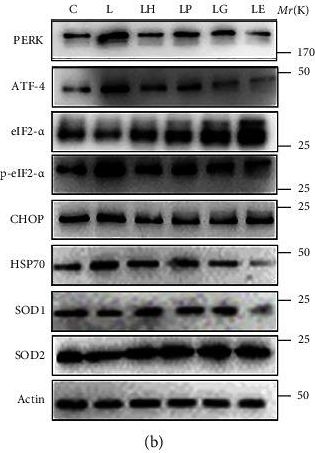 Fig.4.B showing Western Blotting in a Mus musculus (House mouse) sample from the publication: Inhibition of TRPA1 Ameliorates Periodontitis by Reducing Periodontal Ligament Cell Oxidative Stress and Apoptosis via PERK/eIF2α/ATF-4/CHOP Signal Pathway.