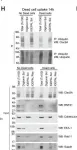 Fig.5.H showing Western Blotting from the publication: RNF41 regulates the damage recognition receptor Clec9A and antigen cross-presentation in mouse dendritic cells.