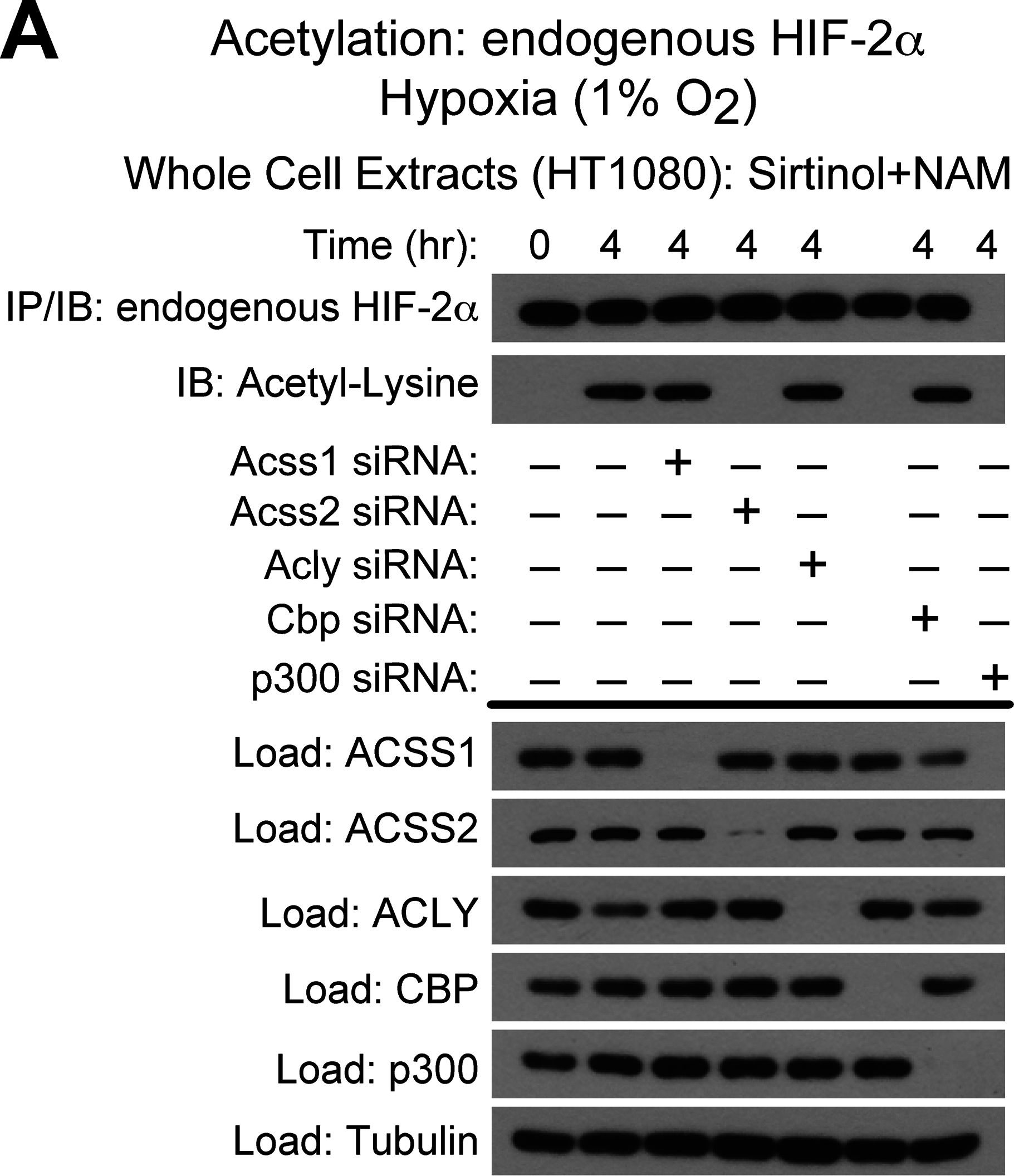 Fig.2.A showing Western Blotting in a Homo sapiens (Human) sample from the publication: The acetate/ACSS2 switch regulates HIF-2 stress signaling in the tumor cell microenvironment.