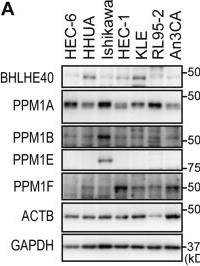 Fig.1.A showing Western Blotting from the publication: The BHLHE40‒PPM1F‒AMPK pathway regulates energy metabolism and is associated with the aggressiveness of endometrial cancer.