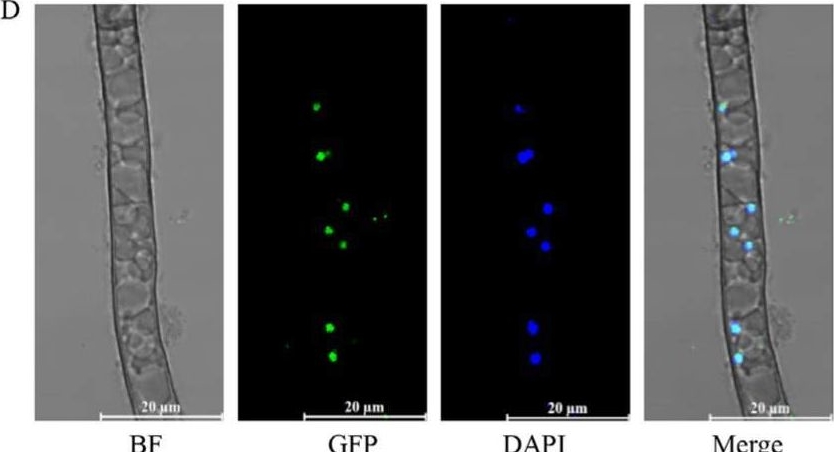 Fig.1.D showing Immunocytochemistry-immunofluorescence from the publication: CBC Complex Regulates Hyphal Growth, Sclerotial Quantity, and Pathogenicity in the Necrotrophic Fungus Botrytis cinerea.