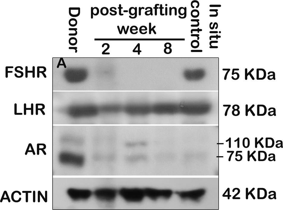 Fig.6.A showing Western Blotting in a Rattus norvegicus (Rat) sample from the publication: Altered hormonal milieu and dysregulated protein expression can cause spermatogenic arrest in ectopic xenografted immature rat testis.