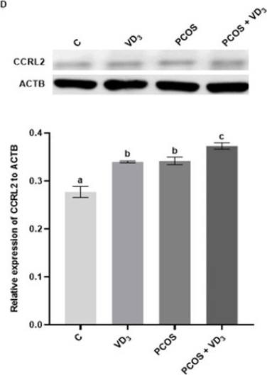 Fig.5.D showing Western Blotting in a Rattus norvegicus (Rat) sample from the publication: Effect of Vitamin D3 on Chemerin and Adiponectin Levels in Uterus of Polycystic Ovary Syndrome Rats.