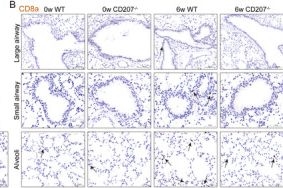 Fig.3.B showing Immunohistochemistry in a Mus musculus (House mouse) sample from the publication: CD207-Positive Dendritic Cells Promote Emphysema Through CD8+ T Cell Pathway in Chronic Obstructive Pulmonary Disease.