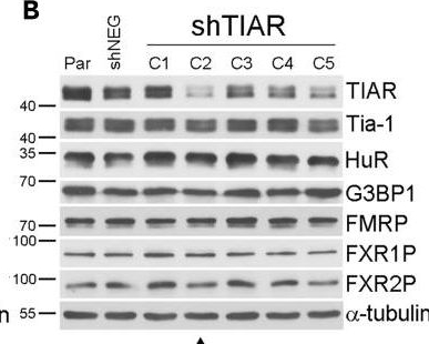 Fig.5.B showing Western Blotting in a Homo sapiens (Human) sample from the publication: TIAR and FMRP shape pro-survival nascent proteome of leukemia cells in the bone marrow microenvironment.