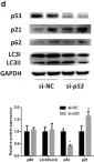 Fig.2.D showing Western Blotting from the publication: Silencing of functional p53 attenuates NAFLD by promoting HMGB1-related autophagy induction.