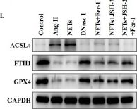 Fig.4.L showing Western Blotting from the publication: NETs drive myocardial fibrosis in hypertension via an NF-κB/ferroptosis axis.