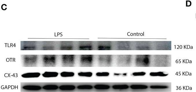 Fig.4.C showing Western Blotting in a Mus musculus (House mouse) sample from the publication: Elevated expression of Toll-like receptor 4 and cytokines in both serum and myometrium at term may serve as promising biomarkers for uterine activation preceding labor.