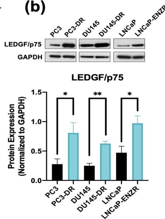 Fig.2.B showing Western Blotting in a Homo sapiens (Human) sample from the publication: The GR-LEDGF/p75-HSP27 Axis Contributes to Cross-Resistance Between Enzalutamide and Docetaxel in Prostate Cancer.