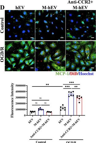 Fig.4.D showing Immunocytochemistry-immunofluorescence in a Mus musculus (House mouse) sample from the publication: Biomimetic Bone Marrow Monocyte Membrane-Fused Extracellular Vesicles for Targeted Therapy of Myocardial Infarction.