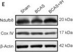 Fig.6.E showing Western Blotting in a Mus musculus (House mouse) sample from the publication: Intermittent hypoxic perconditioning improves cognitive function in a mouse model of vascular cognitive impairment and dementia with comorbidities by recovering cerebral blood flow.