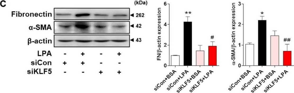 Fig.5.C showing Western Blotting from the publication: Lysophosphatidic Acid Promotes Epithelial-Mesenchymal Transition in Kidney Epithelial Cells via the LPAR1/MAPK-AKT/KLF5 Signaling Pathway in Diabetic Nephropathy.