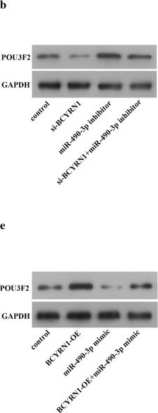Fig.5.B,E showing Western Blotting in a Homo sapiens (Human) sample from the publication: LncRNA BCYRN1/miR-490-3p/POU3F2, served as a ceRNA network, is connected with worse survival rate of hepatocellular carcinoma patients and promotes tumor cell growth and metastasis.