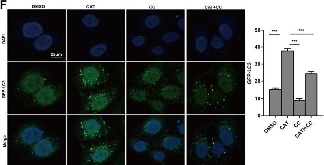 Fig.4.F showing Immunocytochemistry-immunofluorescence from the publication: Catalpol induces autophagy and attenuates liver steatosis in ob/ob and high-fat diet-induced obese mice.