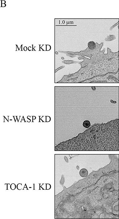Fig.4.B showing Immunohistochemistry in a Homo sapiens (Human) sample from the publication: Chlamydia trachomatis TmeA promotes pedestal-like structure formation through N-WASP and TOCA-1 interactions.