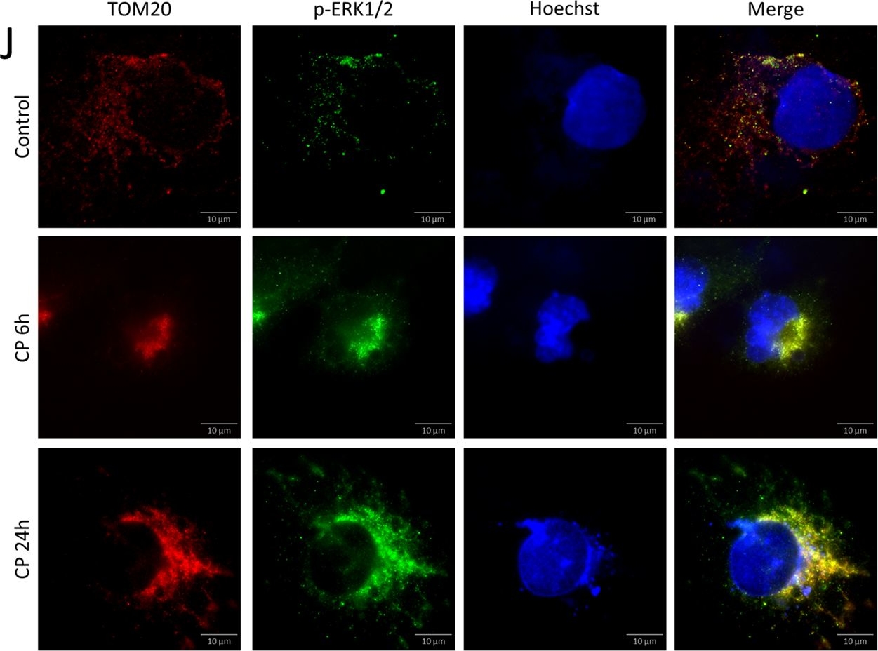 Fig.1.J showing Immunocytochemistry-immunofluorescence in a Mus musculus (House mouse) sample from the publication: The interplay of mitophagy, autophagy, and apoptosis in cisplatin-induced kidney injury: involvement of ERK signaling pathway.