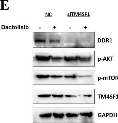 Fig.4.E showing Western Blotting in a Homo sapiens (Human) sample from the publication: Transmembrane-4 L-six family member-1 (TM4SF1) promotes non-small cell lung cancer proliferation, invasion and chemo-resistance through regulating the DDR1/Akt/ERK-mTOR axis.