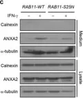 Fig.3.C showing Western Blotting in a Homo sapiens (Human) sample from the publication: Exophagy of annexin A2 via RAB11, RAB8A and RAB27A in IFN-γ-stimulated lung epithelial cells.