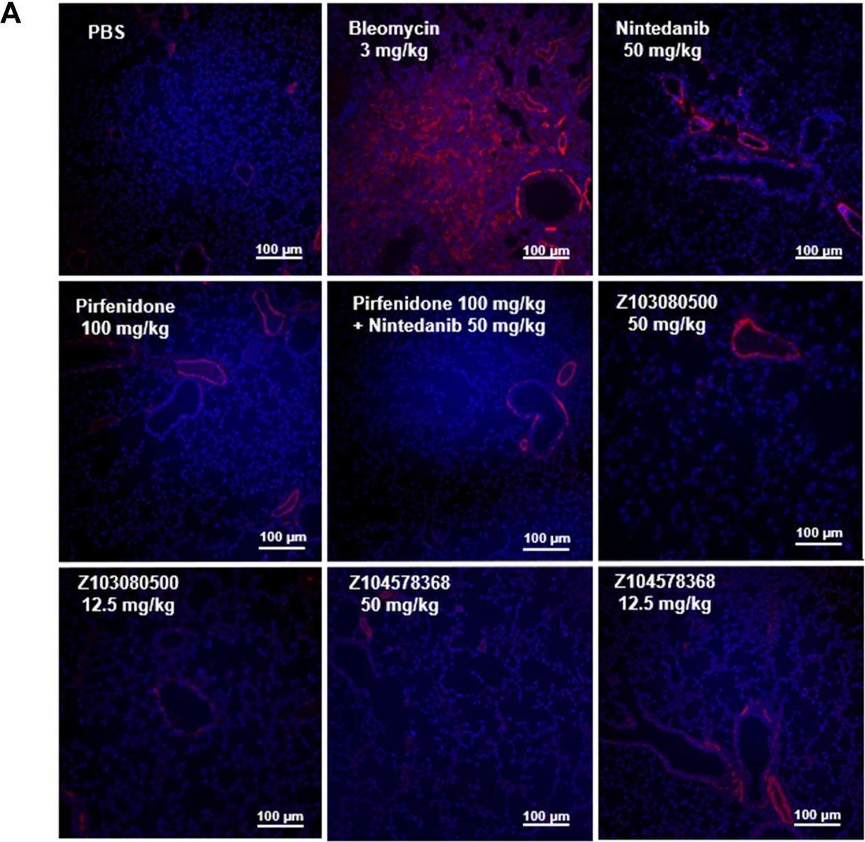 Fig.6.A from the publication: Virtual screening and activity evaluation of multitargeting inhibitors for idiopathic pulmonary fibrosis.