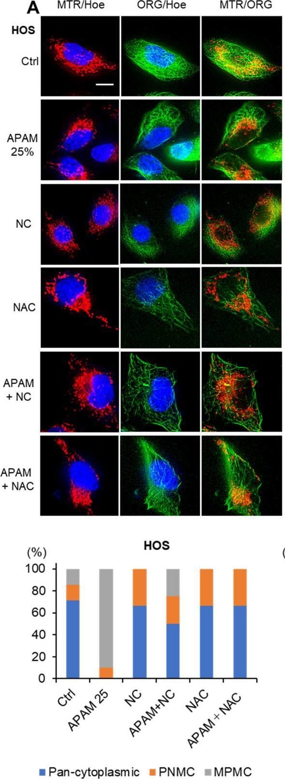 Fig.5.A showing Immunocytochemistry-immunofluorescence from the publication: Air Plasma-Activated Medium Evokes a Death-Associated Perinuclear Mitochondrial Clustering.