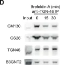 Fig.6.D showing Western Blotting in a Homo sapiens (Human) sample from the publication: Golgi self-correction generates bioequivalent glycans to preserve cellular homeostasis.