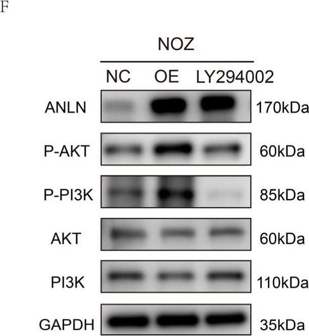 Fig.5.F showing Western Blotting in a Homo sapiens (Human) sample from the publication: ANLN Promotes the Proliferation and Migration of Gallbladder Cancer Cells via STRA6-Mediated Activation of PI3K/AKT Signaling.
