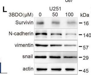 Fig.1.L showing Western Blotting from the publication: 3BDO inhibits the proliferation, epithelial-mesenchymal transition (EMT), and stemness via suppressing survivin in human glioblastoma cells.