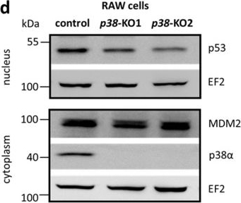 Fig.9.D showing Western Blotting in a Mus musculus (House mouse) sample from the publication: MK2/p38/p53 Suppress Basal IL-1β and Non-Canonical NF-κB Signaling in Macrophages.