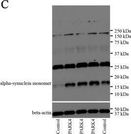 Fig.1.C showing Western Blotting in a Mus musculus (House mouse) sample from the publication: Blood RNA biomarkers in prodromal PARK4 and rapid eye movement sleep behavior disorder show role of complexin 1 loss for risk of Parkinson's disease.