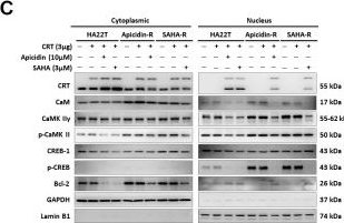 Fig.4.C showing Western Blotting in a Homo sapiens (Human) sample from the publication: Calreticulin nuclear translocalization alleviates CaM/CaMKII/CREB signaling pathway to enhance chemosensitivity in HDAC inhibitor-resistant hepatocellular carcinoma cells.
