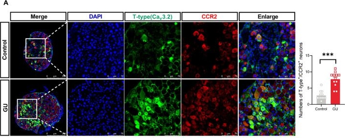 Fig.3.A showing Immunohistochemistry-immunofluorescence in a Mus musculus (House mouse) sample from the publication: CCR2 Regulates Referred Somatic Hyperalgesia by Mediating T-Type Ca2+ Channel Currents of Small-Diameter DRG Neurons in Gastric Ulcer Mice.