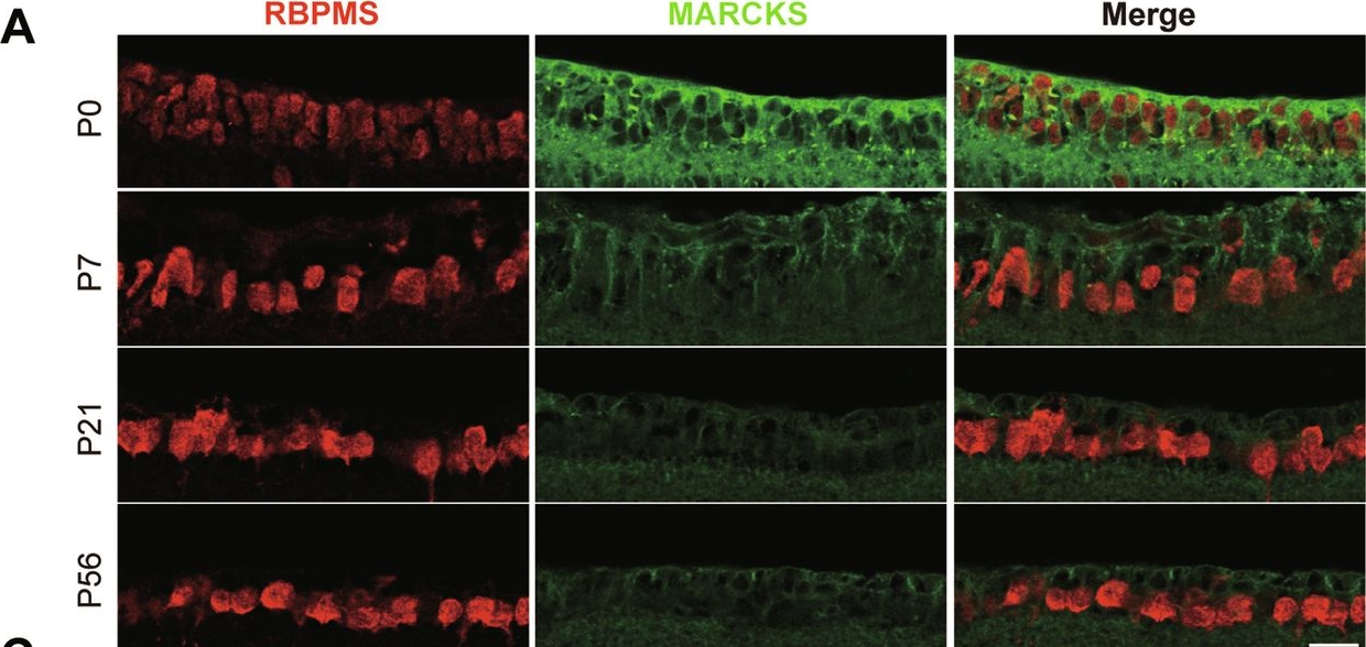 Fig.1.A showing Immunohistochemistry-immunofluorescence in a Mus musculus (House mouse) sample from the publication: Marcks overexpression in retinal ganglion cells promotes optic nerve regeneration.