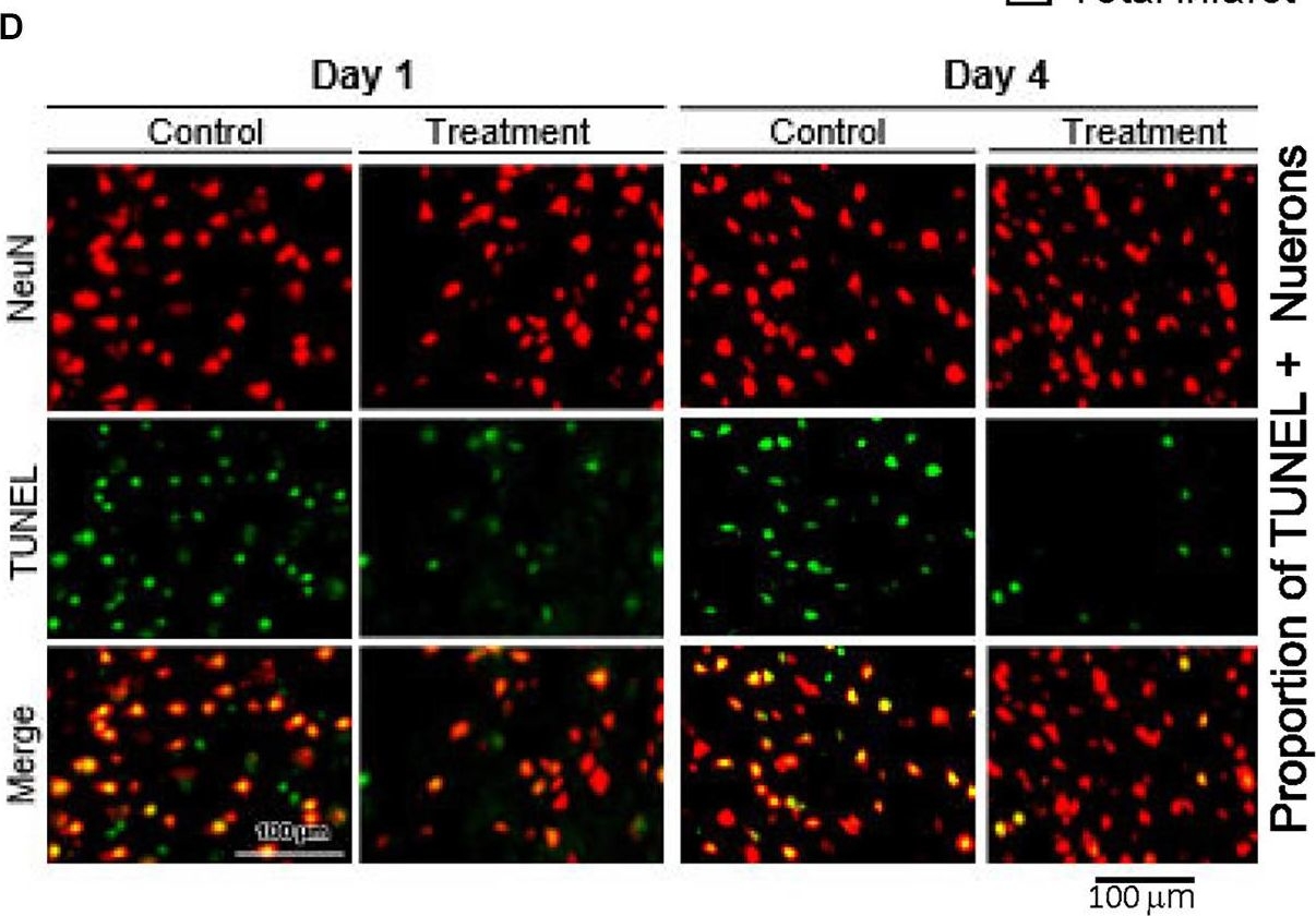 Fig.2.D showing Immunohistochemistry-immunofluorescence in a Rattus norvegicus (Rat) sample from the publication: A steroid receptor coactivator small molecule "stimulator" attenuates post-stroke ischemic brain injury.