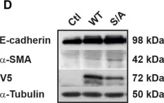 Fig.4.D showing Western Blotting in a Homo sapiens (Human) sample from the publication: Protein kinase B/AKT phosphorylates hypoxia-inducible factor-3α1 in response to insulin, promoting cell growth and migration.