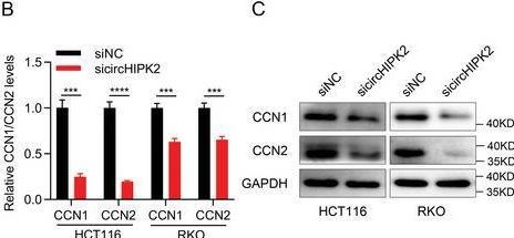 Fig.6.B showing Western Blotting from the publication: CircHIPK2 Contributes Cell Growth in Intestinal Epithelial of Colitis and Colorectal Cancer through Promoting TAZ Translation.