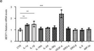 Fig.3.E in a Homo sapiens (Human) sample from the publication: BEST1 Positive Monocytes in Circulation: Visualize Intratumoral Crosstalk between Cancer Cells and Monocytes.