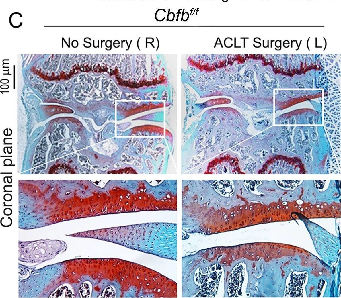 Fig.3.C showing Immunohistochemistry in a Mus musculus (House mouse) sample from the publication: Cbfβ regulates Wnt/β-catenin, Hippo/Yap, and Tgfβ signaling pathways in articular cartilage homeostasis and protects from ACLT surgery-induced osteoarthritis.
