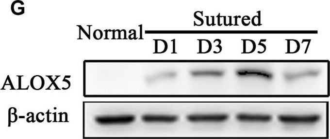 Fig.2.G showing Western Blotting from the publication: Fenofibrate suppresses corneal neovascularization by regulating lipid metabolism through PPARα signaling pathway.