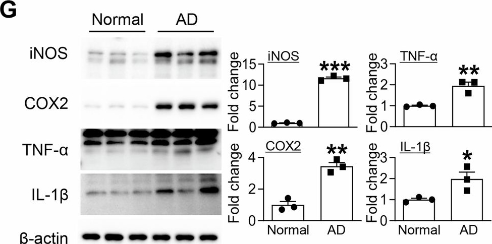 Fig.1.G showing Western Blotting in a Mus musculus (House mouse) sample from the publication: O-GlcNAcylation reprograms microglial inflammatory states and attenuates Alzheimer's disease pathology.