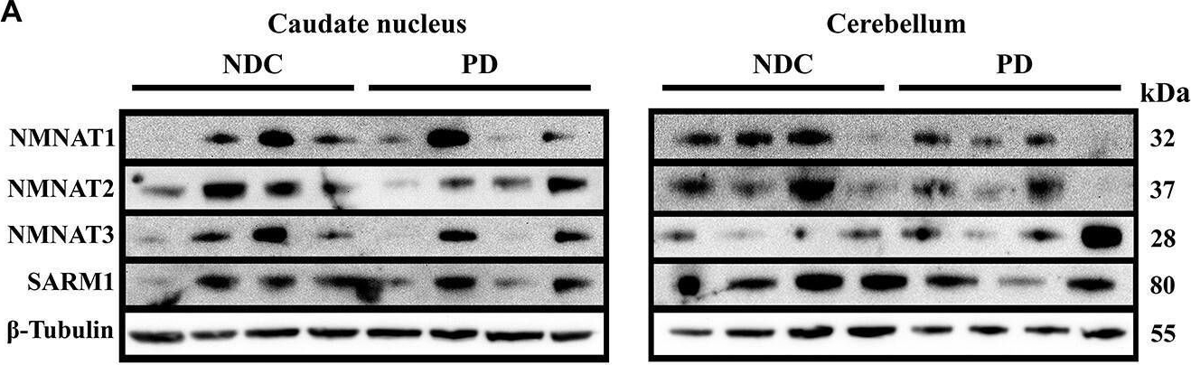 Fig.1.A showing Western Blotting in a Homo sapiens (Human) sample from the publication: Alpha-synucleinopathy reduces NMNAT3 protein levels and neurite formation that can be rescued by targeting the NAD+ pathway.