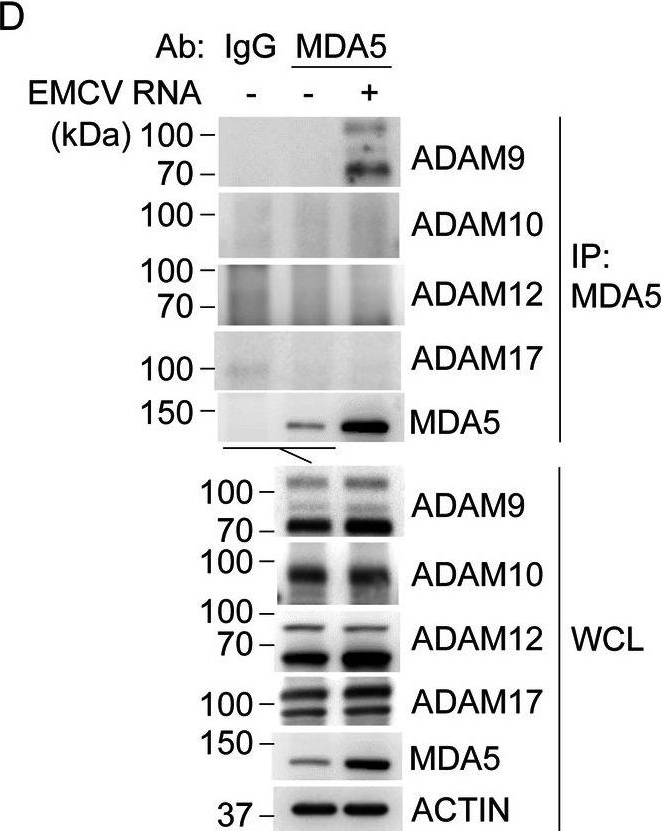 Fig.8.D showing Western Blotting from the publication: ADAM9 promotes type I interferon-mediated innate immunity during encephalomyocarditis virus infection.