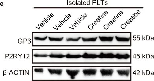 Fig.2.E showing Western Blotting in a Homo sapiens (Human) sample from the publication: Exogenous creatine supplementation promotes tumor metastasis via megakaryocyte creatine kinase B-STAT5B signaling.