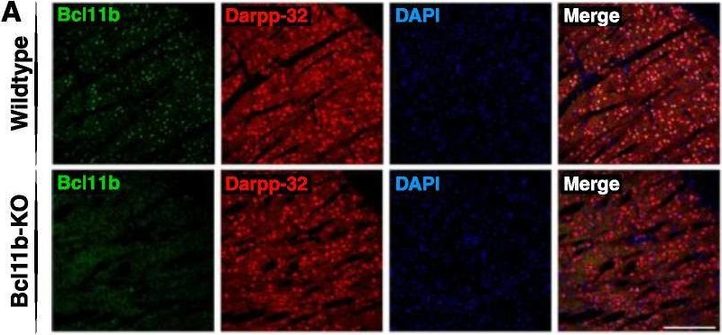 Fig.1.A showing Immunohistochemistry-immunofluorescence from the publication: Postnatal Conditional Deletion of Bcl11b in Striatal Projection Neurons Mimics the Transcriptional Signature of Huntington's Disease.