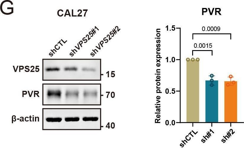 Fig.6.G showing Western Blotting in a Homo sapiens (Human) sample from the publication: VPS25 Promotes an Immunosuppressive Microenvironment in Head and Neck Squamous Cell Carcinoma.