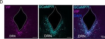 Fig.9.D showing Immunohistochemistry-immunofluorescence in a Mus musculus (House mouse) sample from the publication: Dorsal Raphe VIP Neurons Are Critical for Survival-Oriented Vigilance.