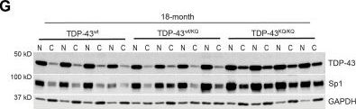 TDP43 (D9R3L) Rabbit Monoclonal Antibody | Cell Signaling Technology