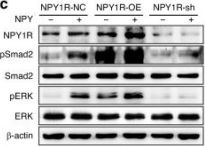 p44/42 MAPK (Erk1/2) (L34F12) Mouse Monoclonal Antibody | Cell