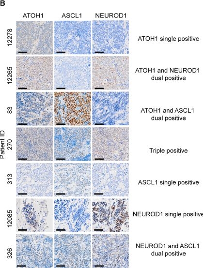 Fig.2.B showing Immunohistochemistry in a Mus musculus (House mouse) sample from the publication: Functional characterization of the ATOH1 molecular subtype indicates a pro-metastatic role in small cell lung cancer.